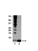 Anti-Ubiquitin Antibody, clone P4D1-A11 clone P4D1-A11, Upstate®, from mouse