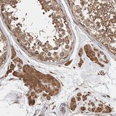 Anti-EIF3H antibody produced in rabbit Prestige Antibodies® Powered by Atlas Antibodies, affinity isolated antibody, buffered aqueous glycerol solution, Ab1