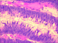 Mayer′s Hematoxylin Solution