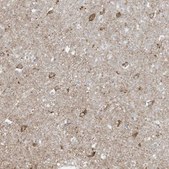 Anti-FNDC1 antibody produced in rabbit Prestige Antibodies® Powered by Atlas Antibodies, affinity isolated antibody, buffered aqueous glycerol solution