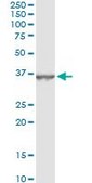 Monoclonal Anti-DHRS9 antibody produced in mouse clone 3E3, purified immunoglobulin, buffered aqueous solution