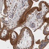 Anti-BNIP2 antibody produced in rabbit Prestige Antibodies® Powered by Atlas Antibodies, affinity isolated antibody, buffered aqueous glycerol solution