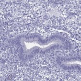 Anti-KIF17 antibody produced in rabbit Prestige Antibodies® Powered by Atlas Antibodies, affinity isolated antibody, buffered aqueous glycerol solution