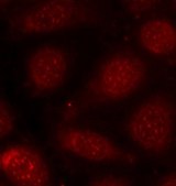 Anti-Phospho-PKCalpha/beta II-T638/641 antibody produced in rabbit