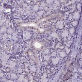 Anti-FOXI1 antibody produced in rabbit Prestige Antibodies® Powered by Atlas Antibodies, affinity isolated antibody, buffered aqueous glycerol solution