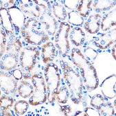 Anti-Lumican (LUM) antibody produced in rabbit