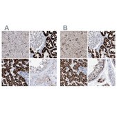 Anti-ALDH6A1 antibody produced in rabbit Prestige Antibodies® Powered by Atlas Antibodies, affinity isolated antibody, buffered aqueous glycerol solution, ab3