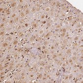 Anti-IGFBP1 antibody produced in rabbit Prestige Antibodies® Powered by Atlas Antibodies, affinity isolated antibody, buffered aqueous glycerol solution