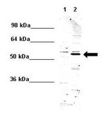 Anti-PRPF19 (AB2) antibody produced in rabbit IgG fraction of antiserum