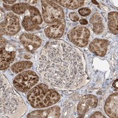 Anti-UQCC1 antibody produced in rabbit Prestige Antibodies® Powered by Atlas Antibodies, affinity isolated antibody, buffered aqueous glycerol solution