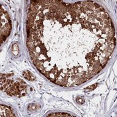 Anti-SUPV3L1 antibody produced in rabbit Prestige Antibodies® Powered by Atlas Antibodies, affinity isolated antibody, buffered aqueous glycerol solution