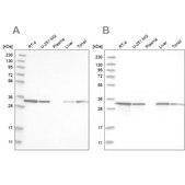 Anti-GLOD4 antibody produced in rabbit Prestige Antibodies® Powered by Atlas Antibodies, affinity isolated antibody, buffered aqueous glycerol solution, Ab1
