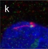 Anti-ODF2 antibody produced in rabbit Prestige Antibodies® Powered by Atlas Antibodies, affinity isolated antibody, buffered aqueous glycerol solution