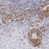 Anti-LAX1 antibody produced in rabbit Ab2, Prestige Antibodies® Powered by Atlas Antibodies, affinity isolated antibody, buffered aqueous glycerol solution