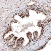 Monoclonal Anti-ARID1A antibody produced in mouse Prestige Antibodies® Powered by Atlas Antibodies, clone CL3595, purified immunoglobulin, buffered aqueous glycerol solution