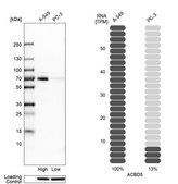 Anti-ACBD5 antibody produced in rabbit Prestige Antibodies® Powered by Atlas Antibodies, affinity isolated antibody, buffered aqueous glycerol solution