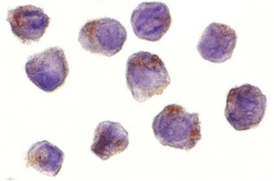 Anti-RICK Antibody from rabbit, purified by affinity chromatography