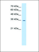 Anti-TRPM5 (AB1) antibody produced in rabbit affinity isolated antibody