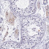 Anti-THSD7A antibody produced in rabbit Prestige Antibodies® Powered by Atlas Antibodies, affinity isolated antibody, buffered aqueous glycerol solution