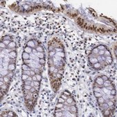 Anti-RPS6KA5 antibody produced in rabbit Prestige Antibodies® Powered by Atlas Antibodies, affinity isolated antibody, buffered aqueous glycerol solution