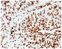 Anti-Phosphotyrosine, clone RM111 Antibody clone RM111, from rabbit, purified by affinity chromatography