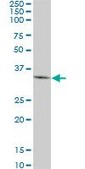 Monoclonal Anti-DKK1 antibody produced in mouse clone 4D4, purified immunoglobulin, buffered aqueous solution