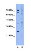 Anti-RHOBTB1 antibody produced in rabbit affinity isolated antibody
