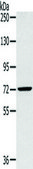 Anti-SLC27A5 affinity isolated antibody