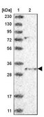 Anti-TSNAX antibody produced in rabbit Prestige Antibodies® Powered by Atlas Antibodies, affinity isolated antibody, buffered aqueous glycerol solution, ab1