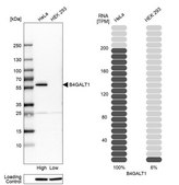Anti-B4GALT1 antibody produced in rabbit Ab2, Prestige Antibodies® Powered by Atlas Antibodies, affinity isolated antibody, buffered aqueous glycerol solution