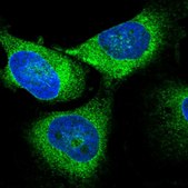 Anti-TECR antibody produced in rabbit Prestige Antibodies® Powered by Atlas Antibodies, affinity isolated antibody, buffered aqueous glycerol solution
