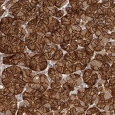 Anti-LGALS8 antibody produced in rabbit Prestige Antibodies® Powered by Atlas Antibodies, affinity isolated antibody, buffered aqueous glycerol solution