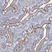 Anti-MYO7B antibody produced in rabbit Prestige Antibodies® Powered by Atlas Antibodies, affinity isolated antibody, buffered aqueous glycerol solution