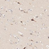 Anti-DYNC1H1 antibody produced in rabbit Prestige Antibodies® Powered by Atlas Antibodies, affinity isolated antibody, buffered aqueous glycerol solution