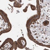 Anti-LTV1 antibody produced in rabbit Prestige Antibodies® Powered by Atlas Antibodies, affinity isolated antibody, buffered aqueous glycerol solution, ab2