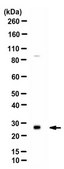 Anti-Catechol O-methyltransferase/COMT Antibody from rabbit, purified by affinity chromatography