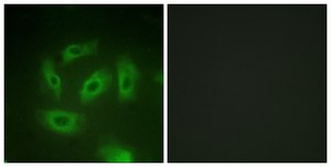 Anti-TGF β Receptor I antibody produced in rabbit affinity isolated antibody