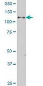 ANTI-EPHB3 antibody produced in mouse clone 2G9, purified immunoglobulin, buffered aqueous solution