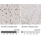 Anti-TBL1XR1 antibody produced in rabbit Prestige Antibodies® Powered by Atlas Antibodies, affinity isolated antibody, buffered aqueous glycerol solution