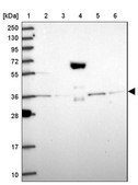 Anti-PEX19 antibody produced in rabbit Prestige Antibodies® Powered by Atlas Antibodies, affinity isolated antibody, buffered aqueous glycerol solution