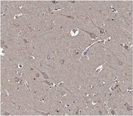 Anti-Amyloid Beta (ABeta) x-42 Antibody, clone 12F4 clone 12F4, from mouse