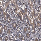 Anti-BCL2L12 antibody produced in rabbit Prestige Antibodies® Powered by Atlas Antibodies, affinity isolated antibody, buffered aqueous glycerol solution