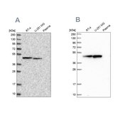 Anti-PAICS antibody produced in rabbit Prestige Antibodies® Powered by Atlas Antibodies, affinity isolated antibody, buffered aqueous glycerol solution