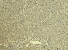 Anti-KCNQ1 (C-terminal) antibody produced in goat affinity isolated antibody, buffered aqueous solution