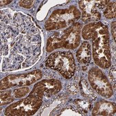 Anti-SOD2 antibody produced in rabbit Prestige Antibodies® Powered by Atlas Antibodies, affinity isolated antibody, buffered aqueous glycerol solution