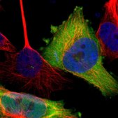 Anti-TWSG1 antibody produced in rabbit Prestige Antibodies® Powered by Atlas Antibodies, affinity isolated antibody, buffered aqueous glycerol solution