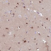 Anti-TMEM132A antibody produced in rabbit Prestige Antibodies® Powered by Atlas Antibodies, affinity isolated antibody, buffered aqueous glycerol solution