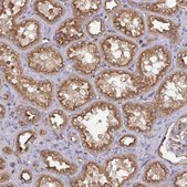 Anti-DYNC1I2 antibody produced in rabbit Prestige Antibodies® Powered by Atlas Antibodies, affinity isolated antibody, buffered aqueous glycerol solution