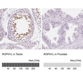 Anti-ROPN1L antibody produced in rabbit affinity isolated antibody, buffered aqueous glycerol solution