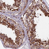 Anti-YBX1 antibody produced in rabbit Prestige Antibodies® Powered by Atlas Antibodies, affinity isolated antibody, buffered aqueous glycerol solution